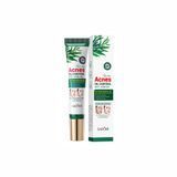 Крем-гель для обличчя проти акне з чайним деревом Sadoer Acnes Oil Control Anti Acne Gel NO.SD50804 фото